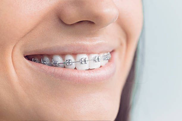Best Dental Fillings (Composite and Amalgam)  in Montrose, MI